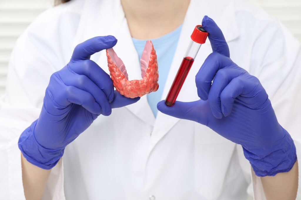 diagnostico-hipotireoidismo-dra-mariana-ataide-medica-endocrinologista-sao-paulo
