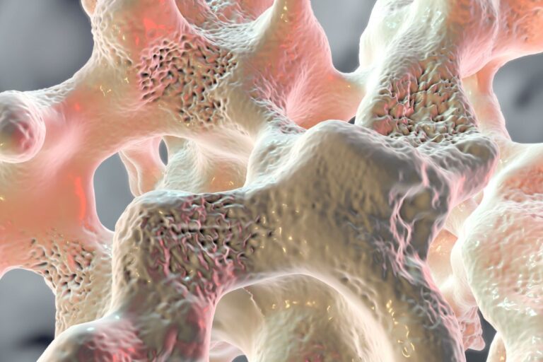 tratamento-osteopenia-dra-mariana-ataide-medica-endocrinologista-sao-paulo-sao-jose-campos