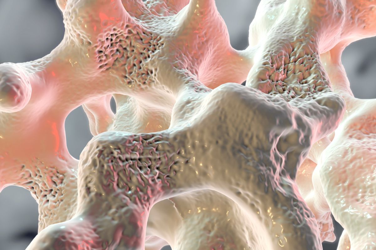 tratamento-osteopenia-dra-mariana-ataide-medica-endocrinologista-sao-paulo-sao-jose-campos